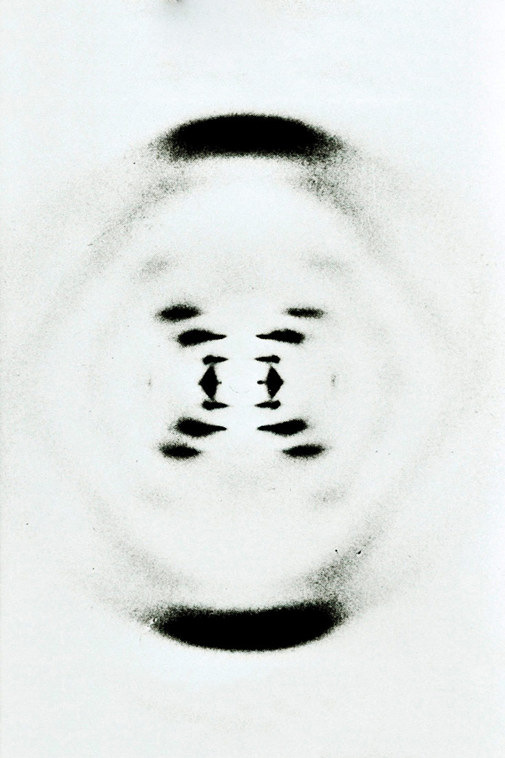 Fotografija prikazuje crno-bijelu snimka DNA dobivena difrakcijom X - zraka. Snimka prikazuje kako X - zrake prelaze preko DNA molekule tvoreći niz uzoraka koji se sastoje od točaka i mrlja različite veličine koje zajedno tvore oblik sličan slovu X.