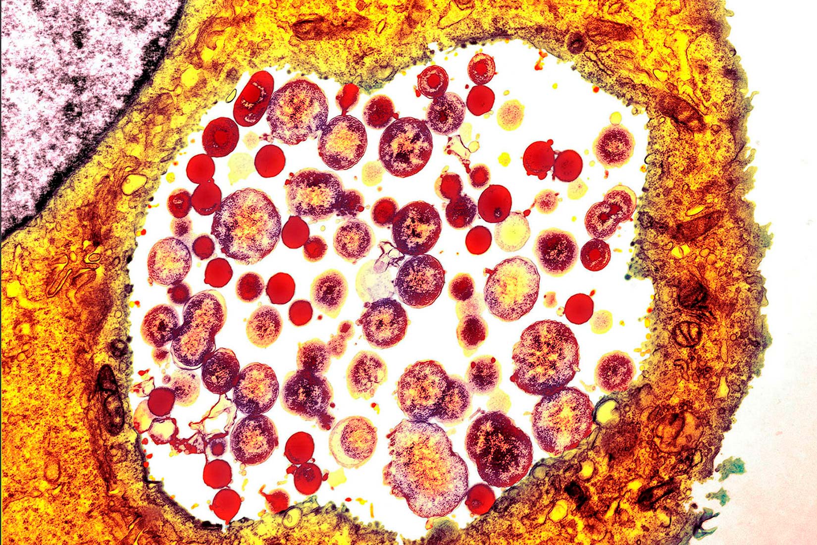 Na slici je prikazan mikroskopski prikaz stanice klamidije. Stjenka je žuta, a unutar nje se nalaze smeđo-žute točke nepravilnog oblika.