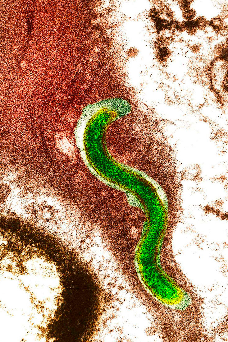 Na slici je prikazan mikroskopski prikaz bakterije sifilisa. Ona izgleda poput zelene gliste.
