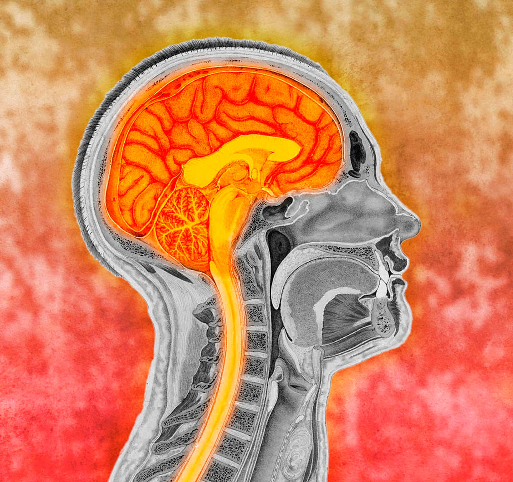 Na slici je prikazan presjek lubanje i vrata. Unutar nje se vide narančasti veliki i mali mozak te se nastavlja u svijetlijoj narančastoj leđna moždina.