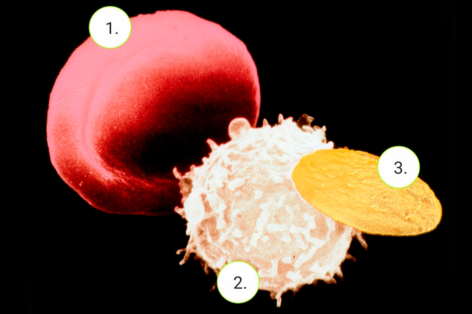 Na slici su prikazane tri različite krvne stanice. Pod brojem 1 nalazi se okrugla krvna stanica crvene boje. Pod brojem 2 se nalazi okrugla stanica bijele boje, nešto manja od crvene, koja po sebi ima male izdanke. Pod brojem 3 se nalazi žuta eliptična stanica, manja od ostalih.