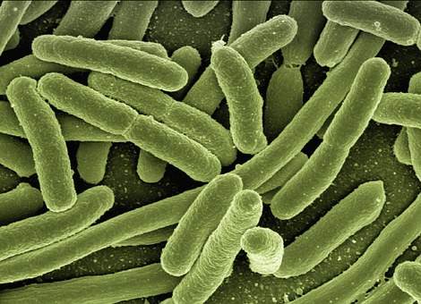 Na slici je kolonija bakterije Esherichie Coli.