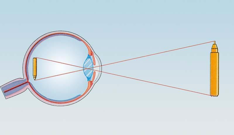Projekcija slike u oku