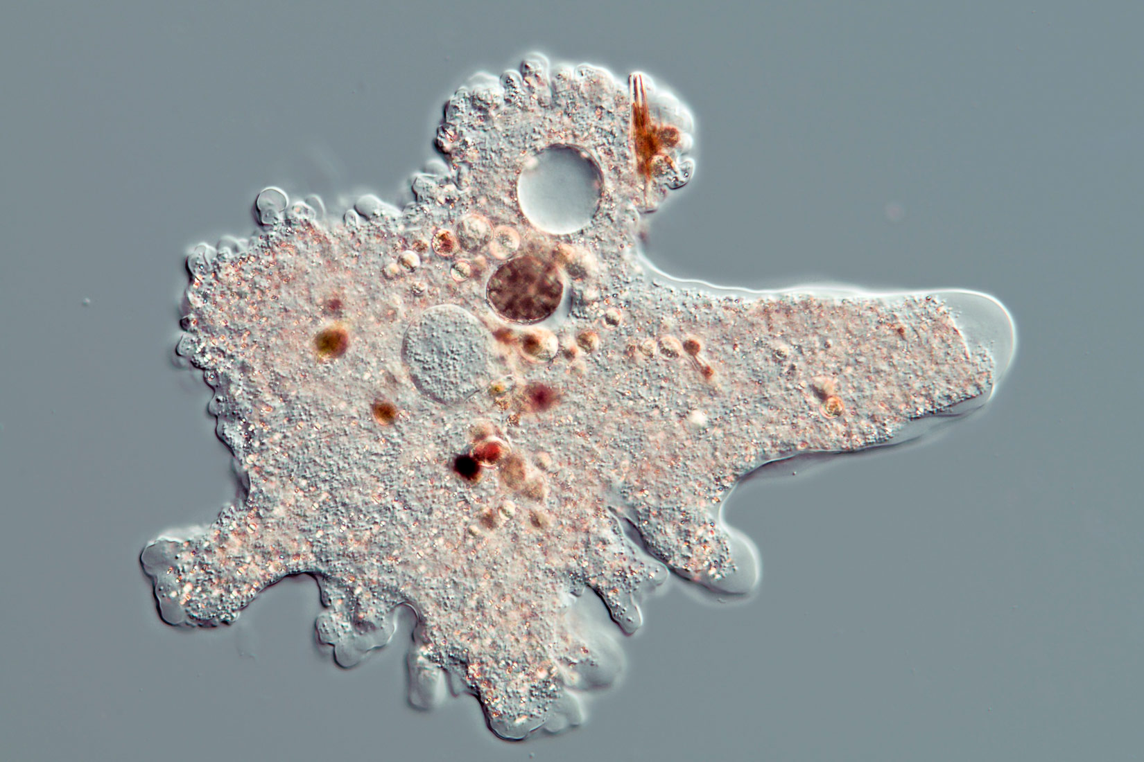 Ameba ima nepravilan oblik koji potječe od dinamičnim pseudopodija koji su zapravo izdanci membrane. Na ovoj slici ona podsjeća na ljudsku ruku gdje prste možemo slikovito poistovjetiti s pseudopodijima. Unutar stanice nalazi se mnoštvo granulica i struktura (staničnih organela).