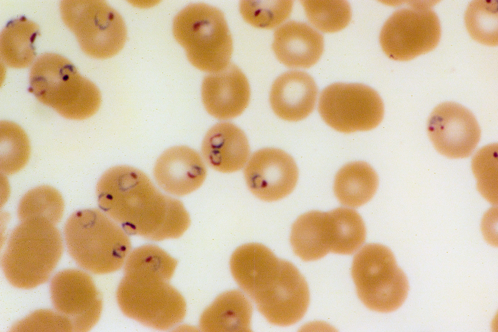 Na slici se nalazi dvadesetak kugličastih organizama bež boje s bijelim središtem. U ponekim stanicama nalaze se kružne strukture ljubičastog oblika.
