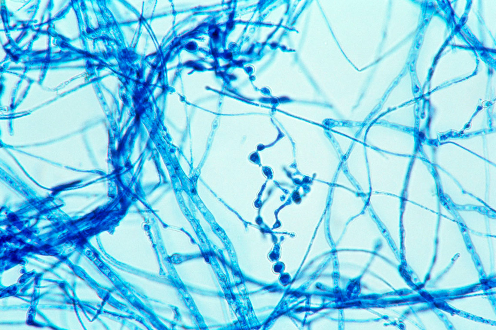 Slika prikazuje nitaste hife gljiva, vrlo isprepletene, vrlo upadljive plave boje.