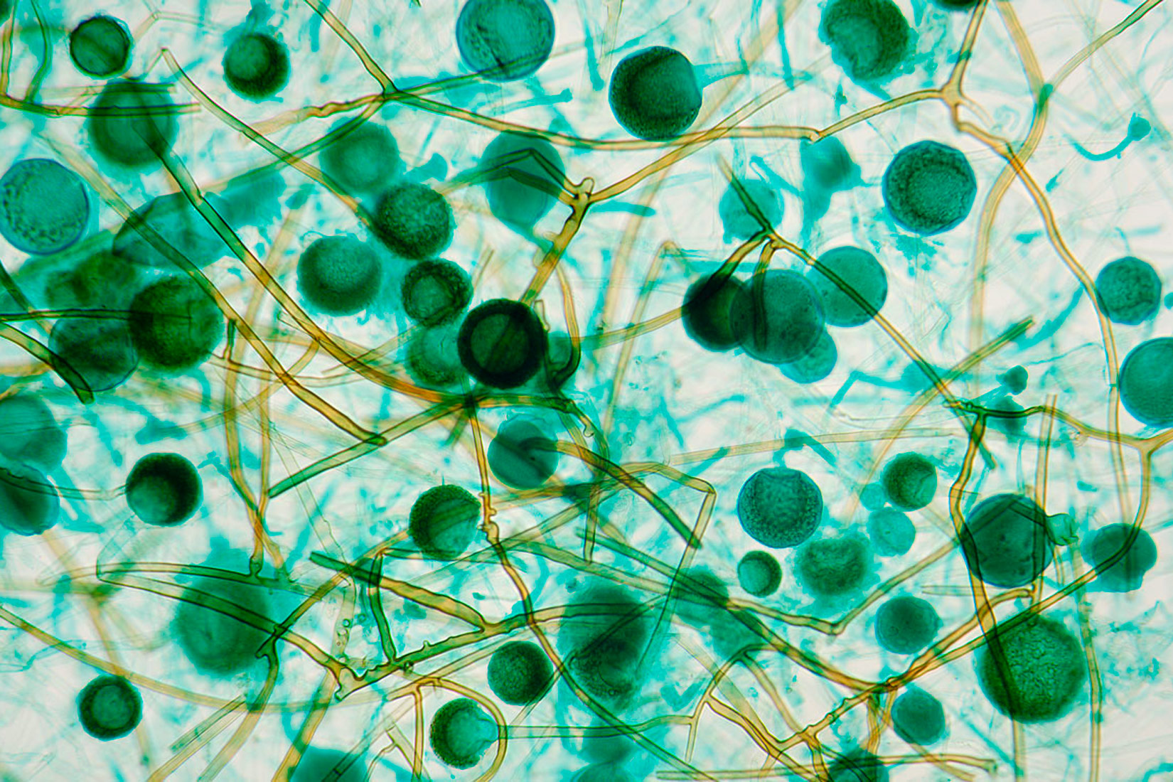Slika prikazuje mikroskopsku sliku plijesni. Pravilnog su kuglišastog oblika i zelene boje, a povezuju ih žućkaste niti.