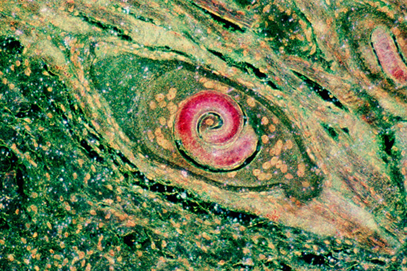 Slika prikazuje mikroskopsku fotografiju organizma koji podsjeća na sklupčanog ljubičastog crva.