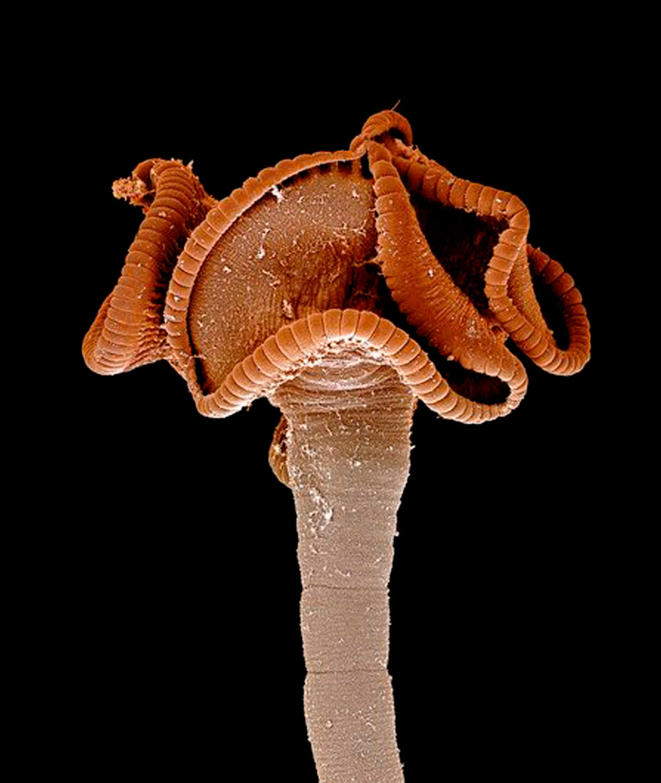 Slika prikazuje smeđu glavu riblje trakavice uslikanu elektronskim mikroskopom.