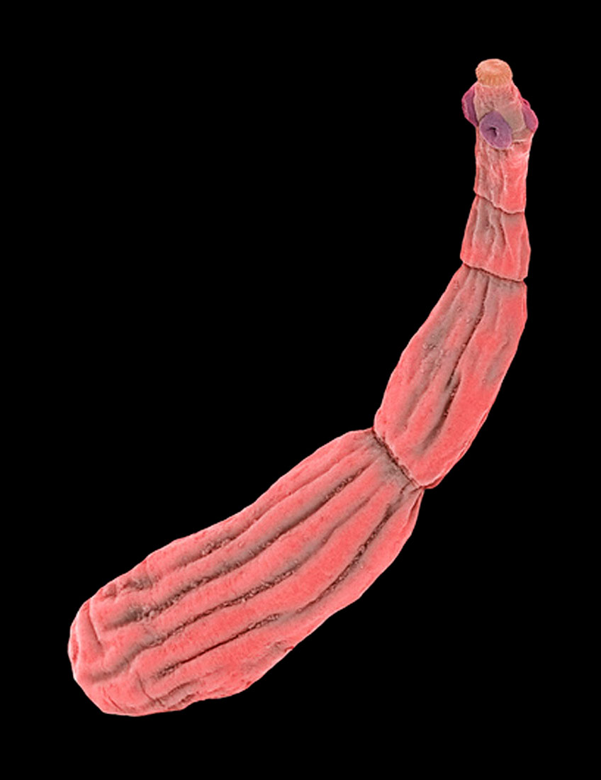 Slika prikazuje pasju trakavicu čije se člankovito, naborano tijelo ružičaste boje postupno sužava od stražnjeg prema prednjem dijelu.
