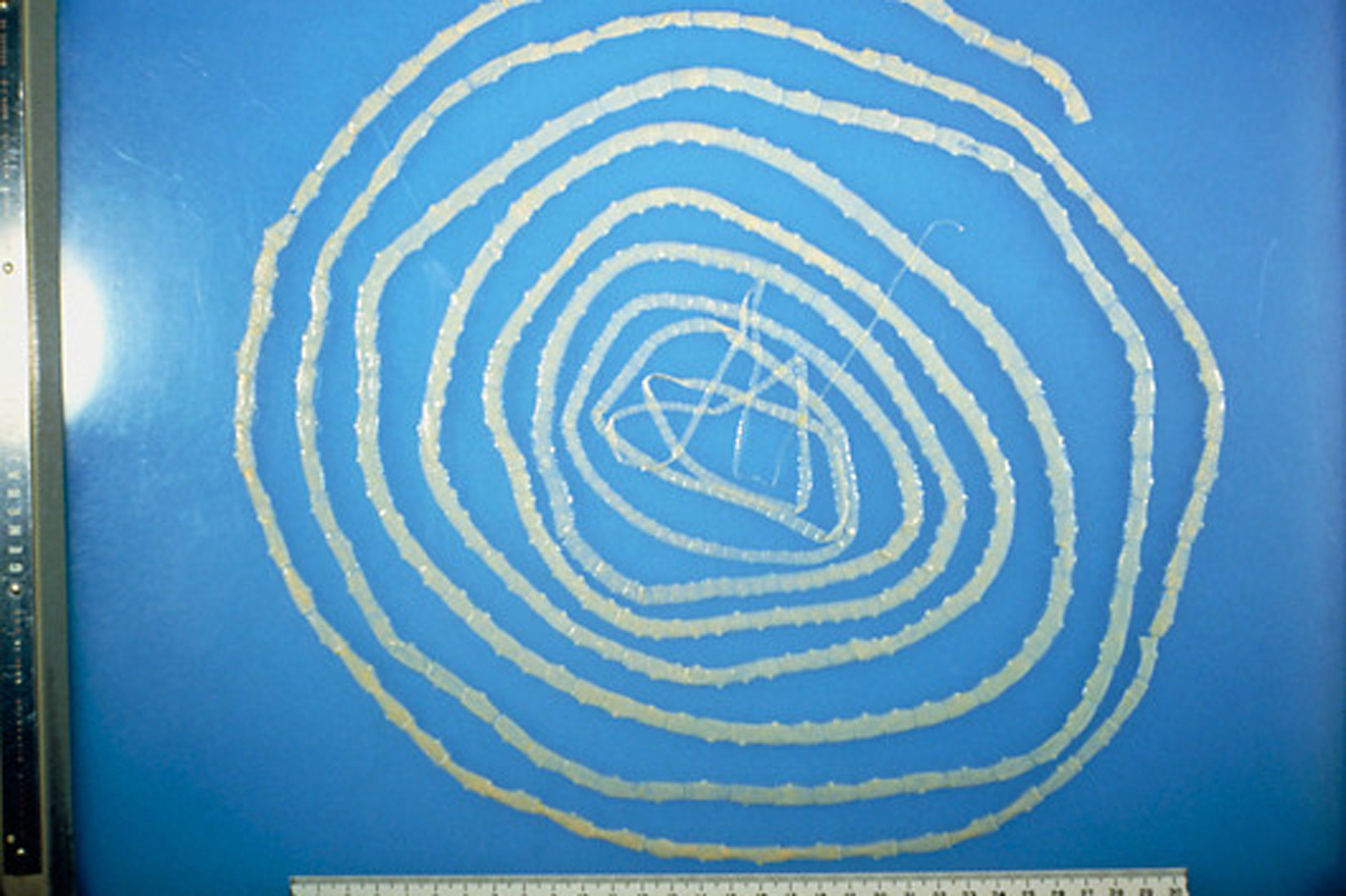 Slika prikazuje goveđu trakavicu koja je smotana u spiralu. Vrlo je dugačka, blijeda i prozirna, a tijelo joj je podijeljeno na članke pravokutnog oblika.