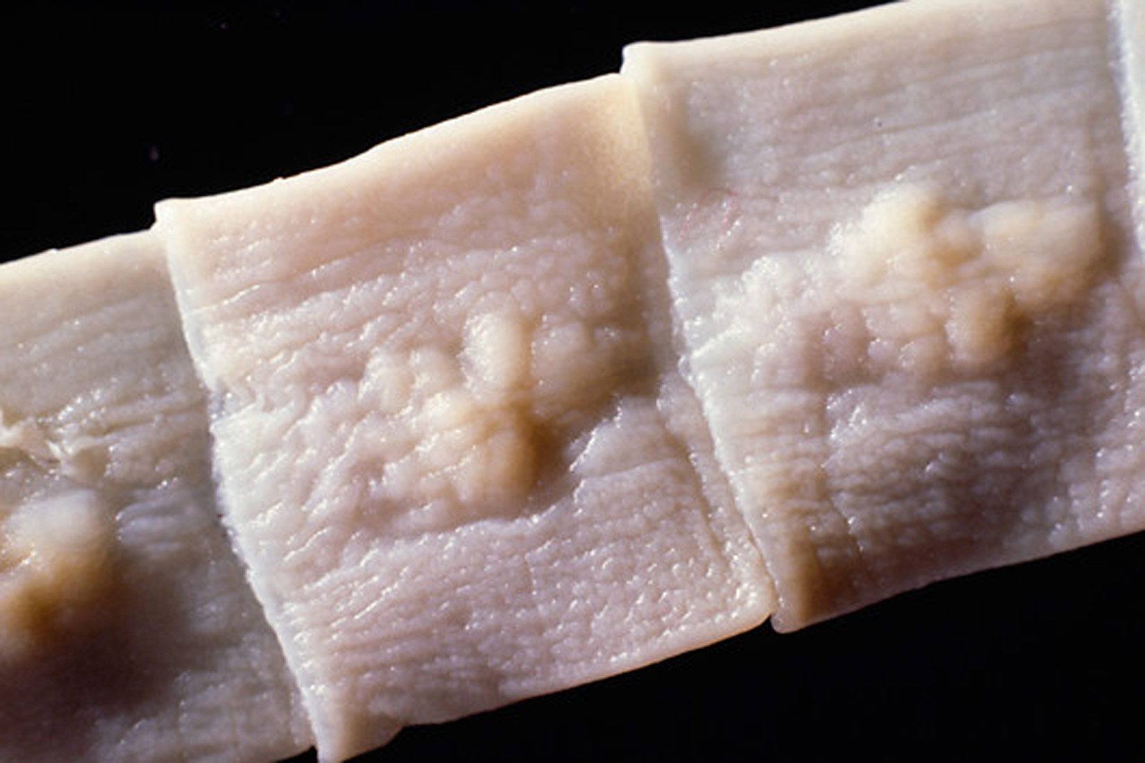 Slika prikazuje uvećanu površinu riblje trakavice. Vidljivi su jasno odijeljeni ružičasti članci s kvržicama u njihovom središtu.